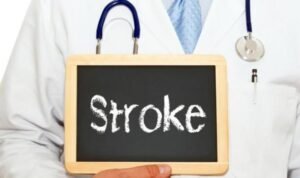 Waspadai Gejala Awal Stroke, Penyakit yang Datang Tanpa Peringatan