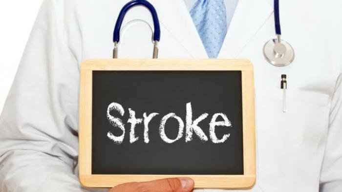 Waspadai Gejala Awal Stroke, Penyakit yang Datang Tanpa Peringatan