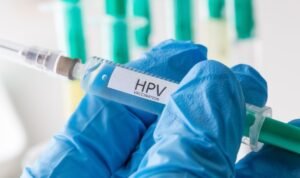 HPV, Penyebab dan Cara Mengobatinya yang Perlu Dipahami Sejak Awal